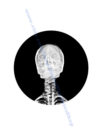  human anatomy, skeleton xray pictures 6 inch circles instant downloads